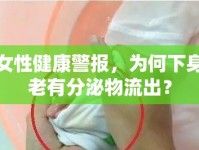 女性健康警報，為何下身老有分泌物流出？