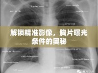 解鎖精準影像，胸片曝光條件的奧秘