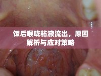 飯后喉嚨粘液流出，原因解析與應對策略
