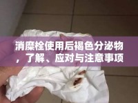 消糜栓使用后褐色分泌物，了解、應(yīng)對(duì)與注意事項(xiàng)