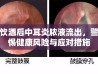 飲酒后中耳炎膿液流出，警惕健康風險與應對措施