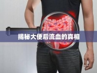 揭秘大便后流血的真相