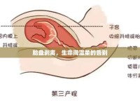 胎盤(pán)剝離，生命間溫柔的告別