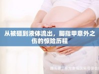 從被砸到液體流出，腳指甲意外之傷的驚險歷程