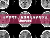 無聲的危機，腦梗死與腦袋有水流出的體驗