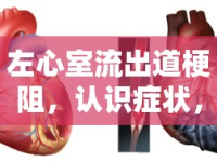 左心室流出道梗阻，認(rèn)識癥狀，守護(hù)心臟健康