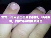 警惕！指甲流出白色粘稠物，惡臭難聞，揭秘背后的健康隱患