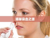 揭秘鼻血之源