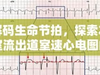 解碼生命節(jié)拍，探索左室流出道室速心電圖的奧秘