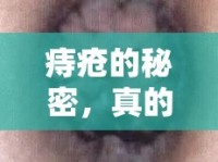 痔瘡的秘密，真的會(huì)有異物流出嗎？