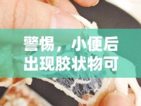 警惕，小便后出現(xiàn)膠狀物可能是健康問題的微妙信號