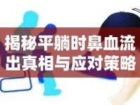 揭秘平躺時鼻血流出真相與應(yīng)對策略