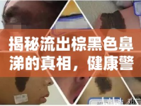 揭秘流出棕黑色鼻涕的真相，健康警報與應對策略