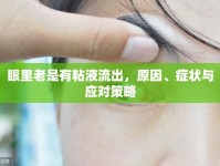 眼里老是有粘液流出，原因、癥狀與應(yīng)對(duì)策略
