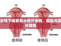 女性下體異常水樣分泌物，原因與應(yīng)對(duì)措施