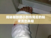 揭秘腳部微小創(chuàng)傷背后的黏液流出真相
