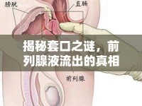 揭秘套口之謎，前列腺液流出的真相與健康考量