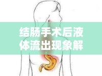 結(jié)腸手術(shù)后液體流出現(xiàn)象解析，術(shù)后護(hù)理與康復(fù)的必備知識