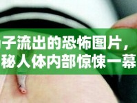 腸子流出的恐怖圖片，揭秘人體內(nèi)部驚悚一幕