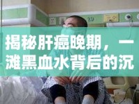 揭秘肝癌晚期，一灘黑血水背后的沉重真相