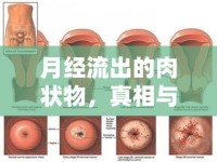 月經(jīng)流出的肉狀物，真相與誤解的深度解析