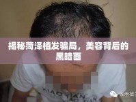 揭秘菏澤植發(fā)騙局，美容背后的黑暗面