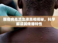 猴痘病毒流出液真相揭秘，科學解讀其傳播特性