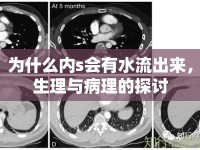 為什么內(nèi)s會(huì)有水流出來(lái)，生理與病理的探討