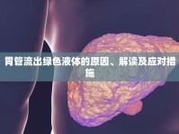 胃管流出綠色液體的原因、解讀及應(yīng)對措施