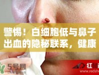 警惕！白細(xì)胞低與鼻子出血的隱秘聯(lián)系，健康警報(bào)與應(yīng)對策略
