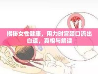 揭秘女性健康，用力時宮頸口流出白道，真相與解讀
