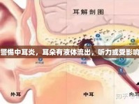 警惕中耳炎，耳朵有液體流出，聽力或受影響
