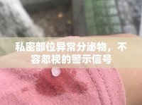 私密部位異常分泌物，不容忽視的警示信號