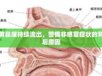 黃鼻屎持續(xù)流出，警惕非感冒癥狀的背后原因