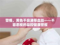 警惕，黃色干鼻涕帶血絲——不容忽視的鼻腔健康警報(bào)