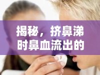 揭秘，擠鼻涕時(shí)鼻血流出的背后真相