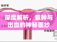 深度解析，囊腫與出血的神秘面紗