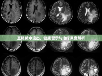 直腸膿水流出，健康警示與治療深度解析