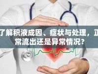 了解積液成因、癥狀與處理，正常流出還是異常情況？