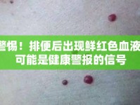 警惕！排便后出現(xiàn)鮮紅色血液，可能是健康警報的信號