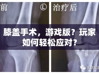 膝蓋手術(shù)，游戲版？玩家如何輕松應(yīng)對？