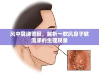 風(fēng)中鼻涕警報(bào)，解析一吹風(fēng)鼻子就流涕的生理現(xiàn)象