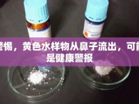警惕，黃色水樣物從鼻子流出，可能是健康警報(bào)