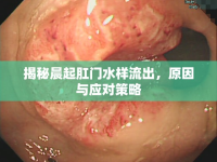 揭秘晨起肛門(mén)水樣流出，原因與應(yīng)對(duì)策略