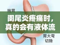 闌尾炎疼痛時，真的會有液體流出嗎？——一場身體小秘密的科普之旅