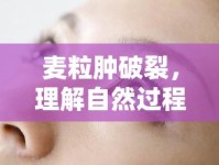 麥粒腫破裂，理解自然過(guò)程與應(yīng)對(duì)策略