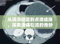 從涓涓細(xì)流到點(diǎn)滴成珠，探索液體引流的奇妙過(guò)程
