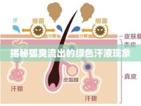 揭秘狐臭流出的綠色汗液現(xiàn)象
