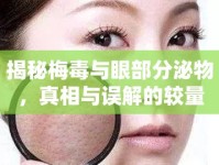 揭秘梅毒與眼部分泌物，真相與誤解的較量
