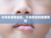 水樣鼻涕帶血絲，不容忽視的健康警報(bào)